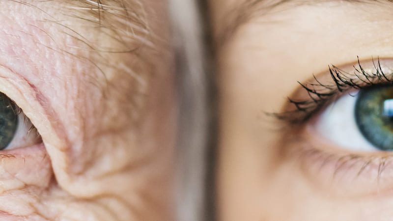 Close de dois olhos lado a lado, um de pessoa idosa e outro de pessoa jovem, destacando as diferenças causadas pelo envelhecimento.