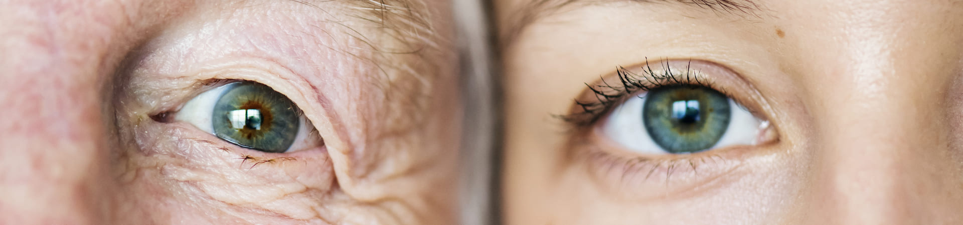 Close de dois olhos lado a lado, um de pessoa idosa e outro de pessoa jovem, destacando as diferenças causadas pelo envelhecimento.
