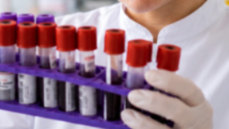 Profissional de laboratório segurando com tubos de coleta de sangue para análise clínica.