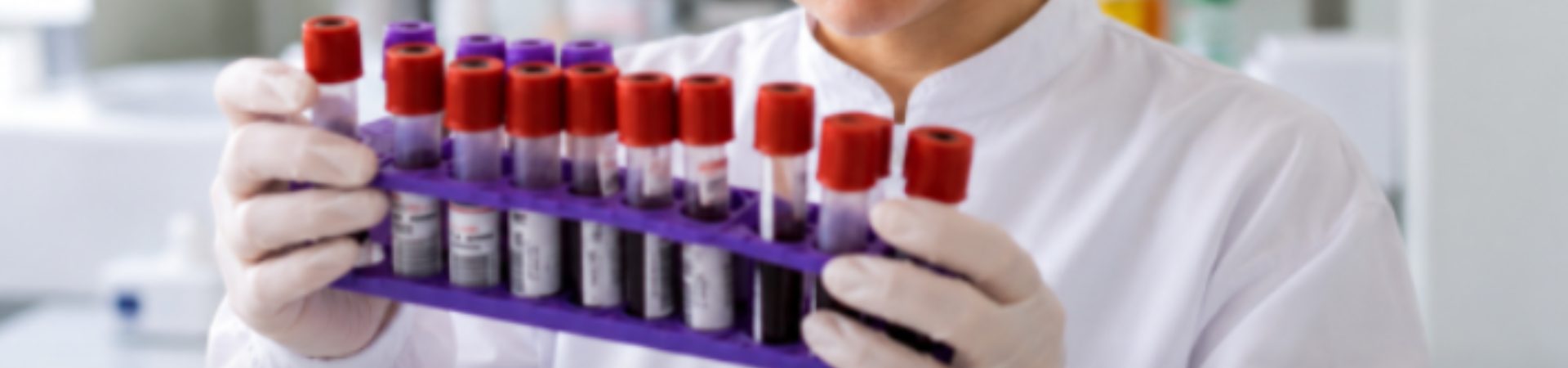 Profissional de laboratório segurando com tubos de coleta de sangue para análise clínica.