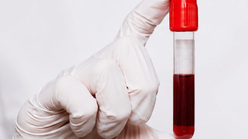Profissional de laboratório segura um tubo de ensaio com amostra de sangue.