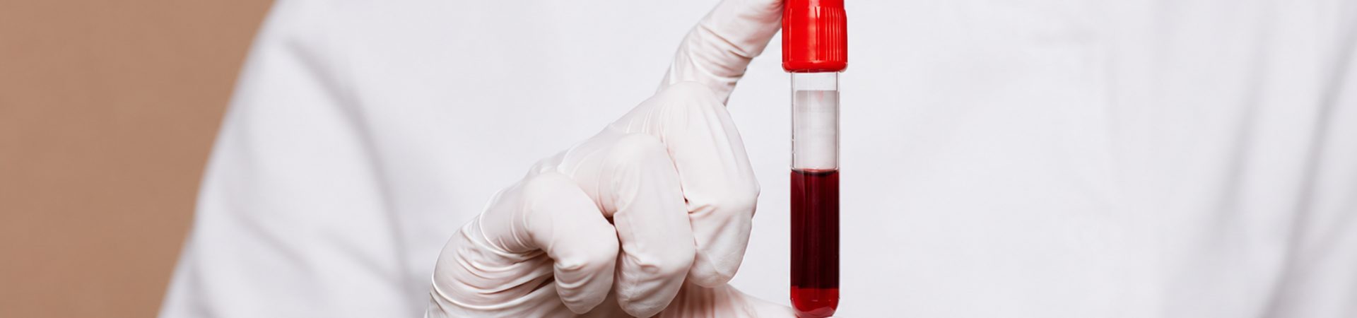 Profissional de laboratório segura um tubo de ensaio com amostra de sangue.